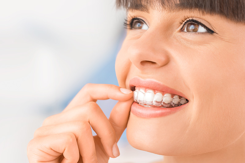 Invisalign in Gastonia